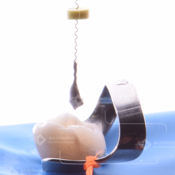 Existe um material obturador com melhor desempenho em dentes decíduos?