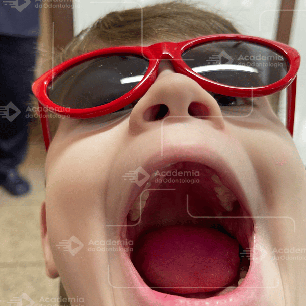 Realidade Virtual e Ruído Branco na Odontologia Infantil
